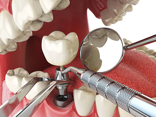 Best Cosmetic Emergency Dentistry in Red Hill, SC